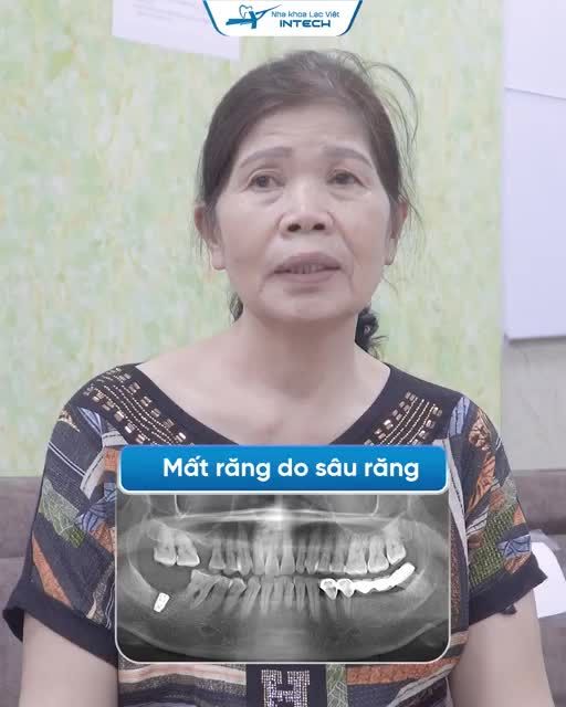 KHÔI PHỤC CHỨC NĂNG ĂN NHAI BẰNG TRỒNG RĂNG IMPLANT CÔNG NGHỆ SAFE TECH